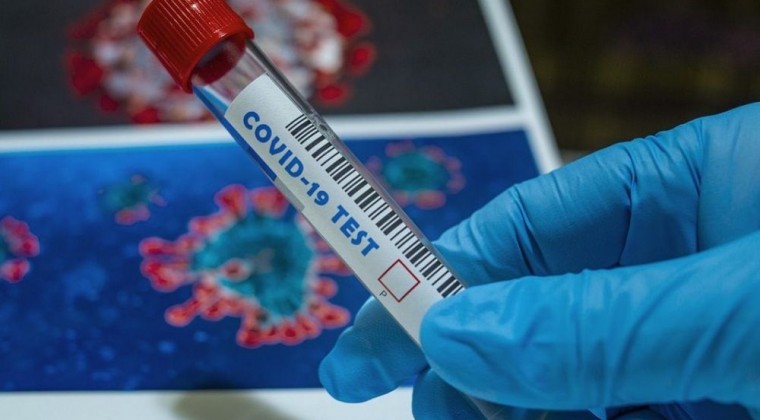 Confirman 630 casos de COVID-19 y 13 nuevos fallecimientos.