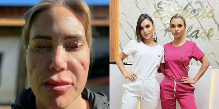 Denuncian por mala praxis a “doctoras barbies”: relato es de terror.