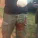 Policías son atacados por supuesto grupo narco en Canindeyú, uno resultó herido.